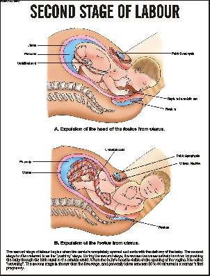 Second Stage of Labour